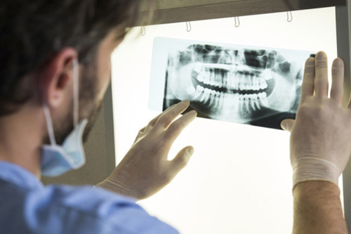 RADIOLOGIA DENTALE